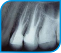 Endodontia