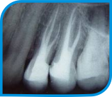 Endodontia